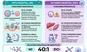 Comparativa de inositol: el DCI en exceso tiene contraindicaciones, afectando la calidad ovocitaria. El MI es más estudiado.